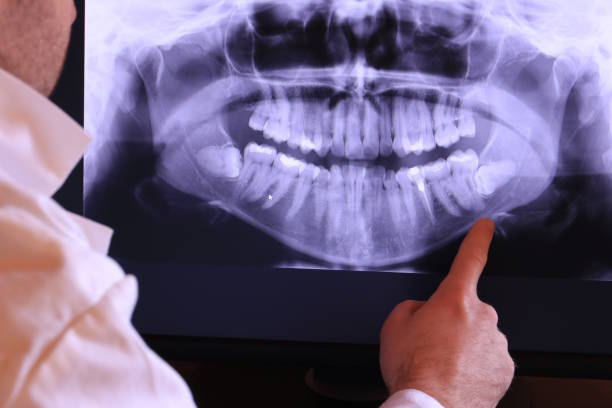 Best Chipped Tooth Repair Near Me  in Marlboro, NY